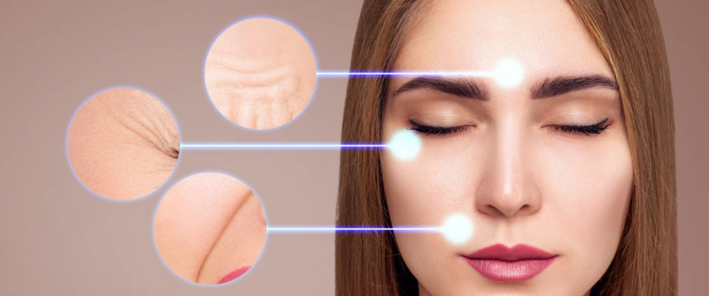 adult acne