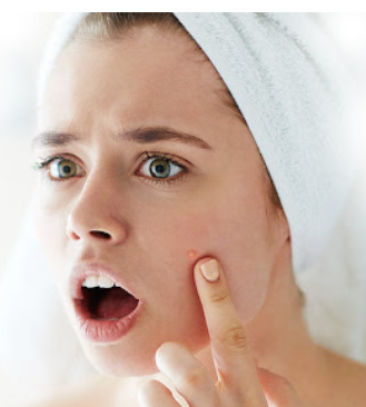 acne treatment Near me