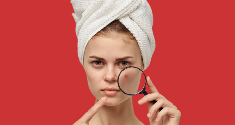 acne treatments near me